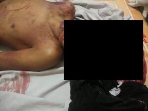 Pagar Tembok Tempat Pemakaman Umum Ambruk Satu Remaja Tewas