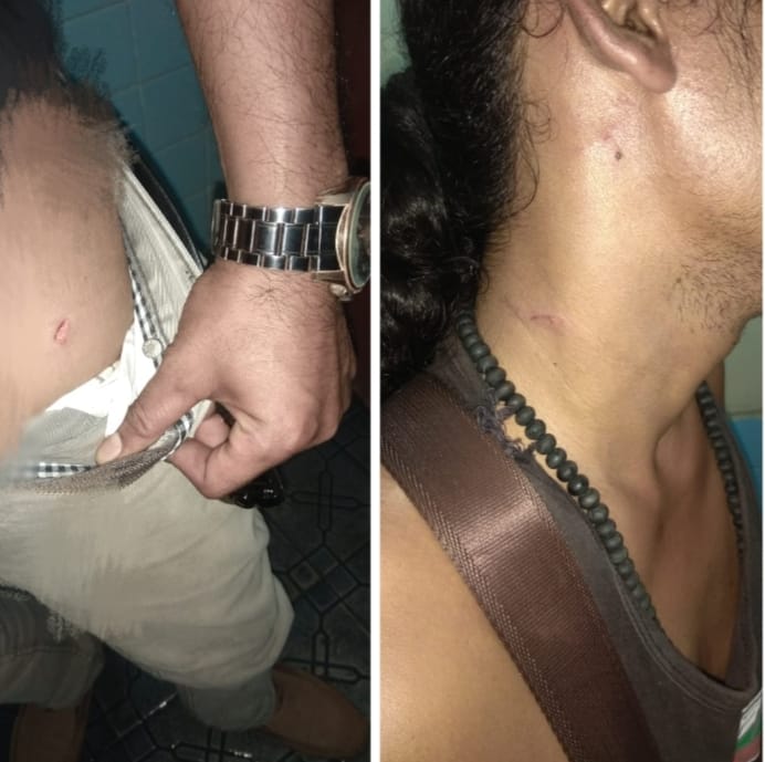 Bentrok Antara Dua Kubu Ormas Di Tanjung Selamat, Koban Penganiayaaan Minta: Pelaku Lainya Segera Di Tangkap