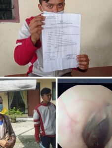 Pasca Penganiayaan Security Perkebunan, Gendang Telinga Korban Pecah