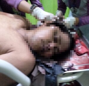 Satu Orang Meninggal Dunia Akibat Bentrok Dua Ormas di Sawit Seberang