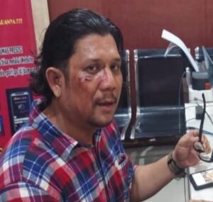 Iwondes Mengutuk Keras Penganiayaan Terhadap Wartawan di Madina