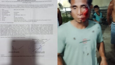Polsek Muara Batang Gadis Diminta Tegakkan Aturan Hukum, Mencari Hati Giawa Dikeroyok Preman Kampung
